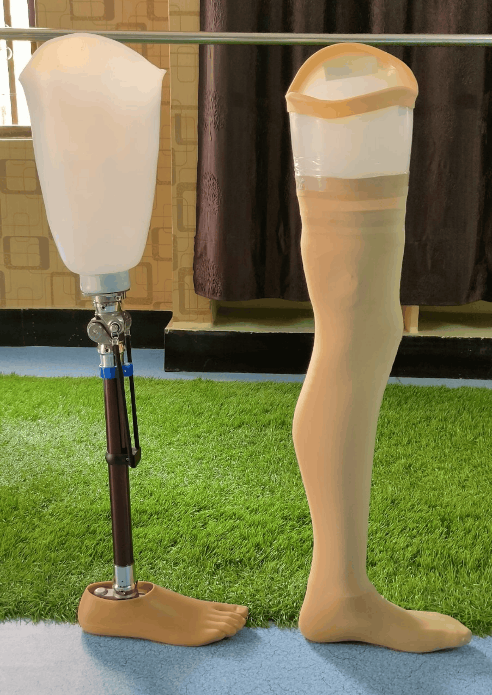 Transfemoral Modular Prosthesis Component Assembly
